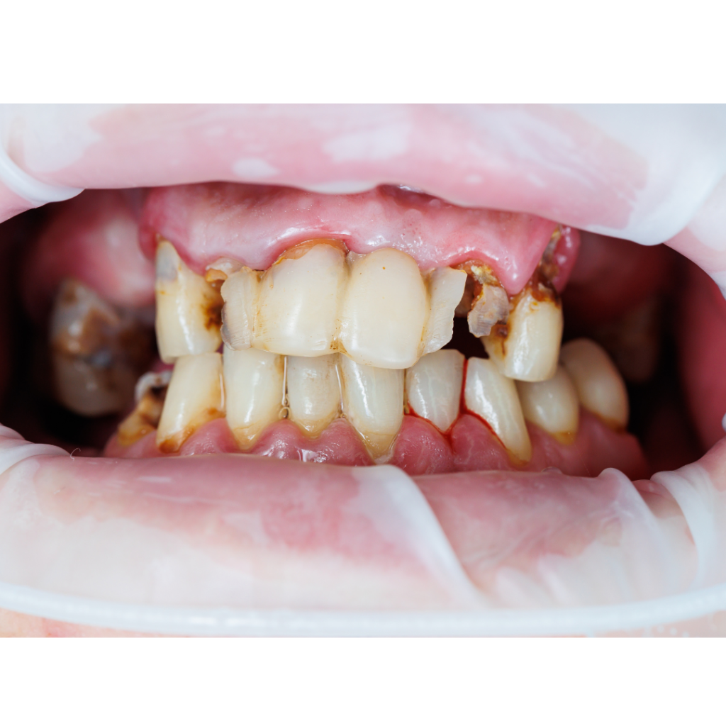 match mouth blog