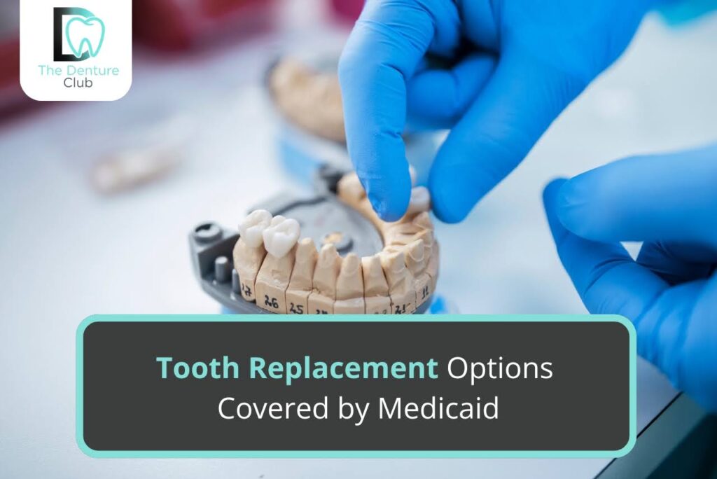 Tooth Replacement Options Covered by Medicaid