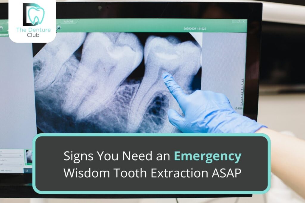 Signs You Need an Emergency Wisdom Tooth Extraction ASAP