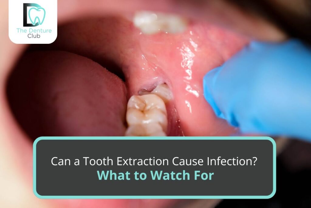 Can-a-Tooth-Extraction-Cause-Infection-What-to-Watch-For.jpg