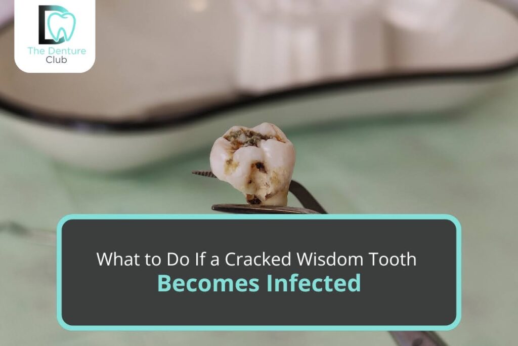 Why Experts Recommend Dental Implants for Long-Term Dental Health?